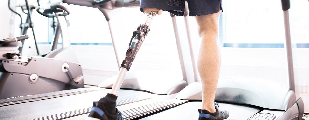 Amputee-rehabilitation-and-prosthetic-training-Advance-Orthopedic-and-Sports-Therapy-Tewksbury-MA