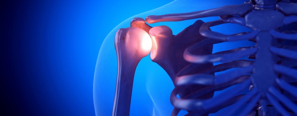 Unveiling the Culprits: Common Causes of Shoulder Pain